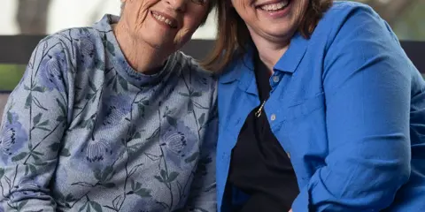What is short-term respite care?